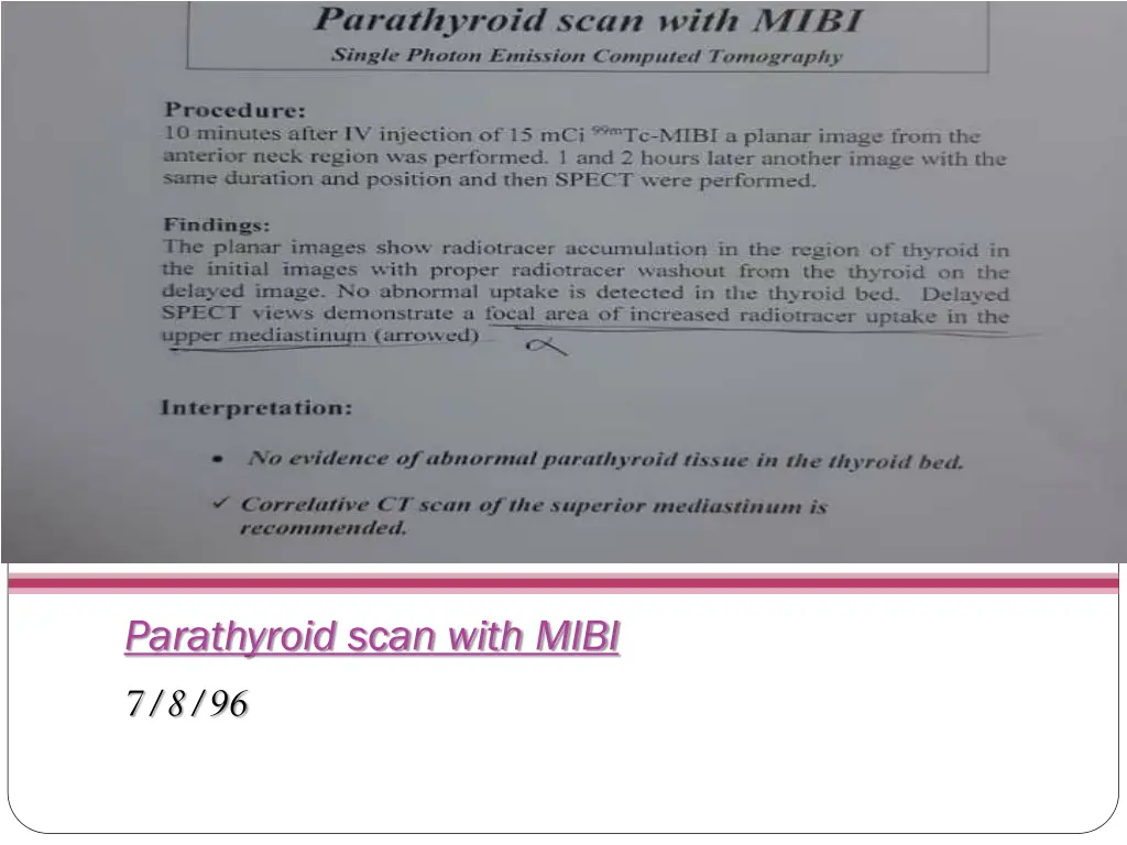 parathyroid scan with mibi 7 8 96