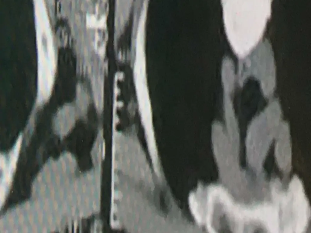 slide34