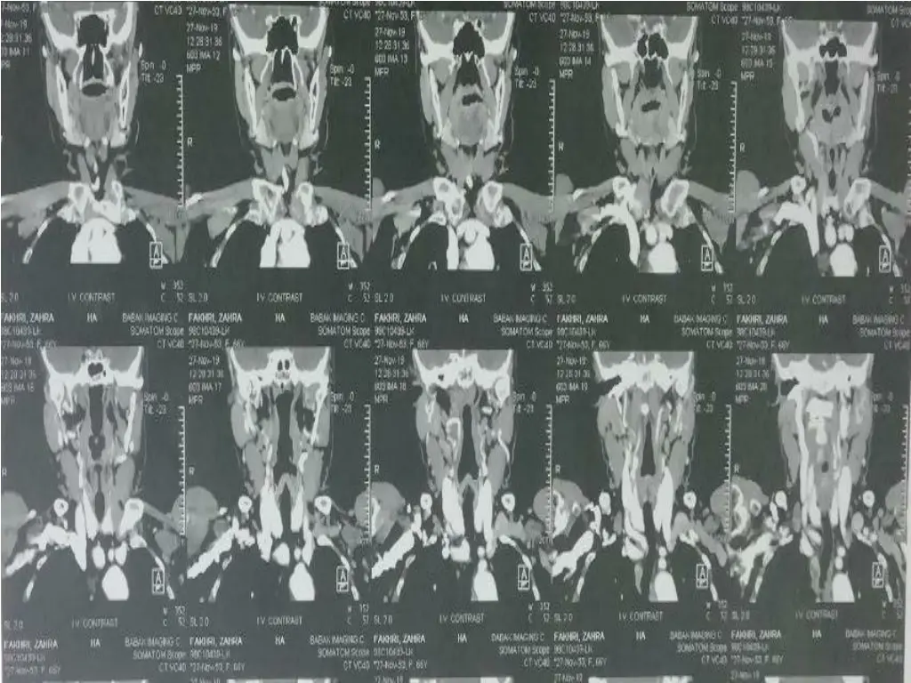 slide37