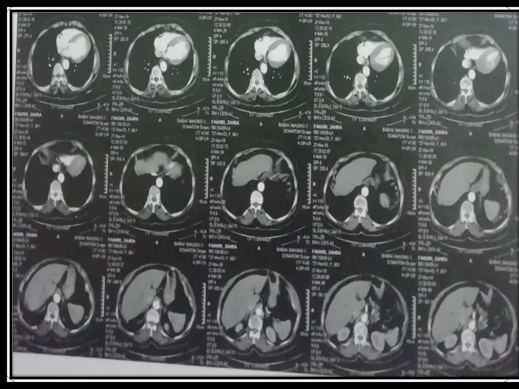 slide38