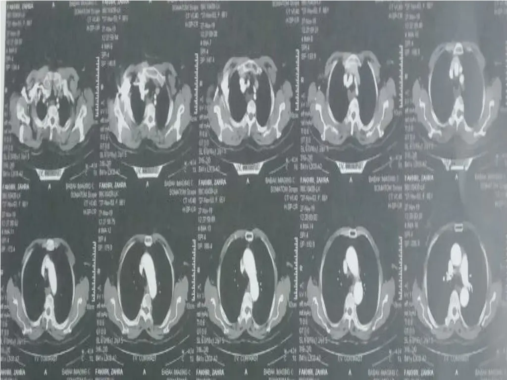 slide39