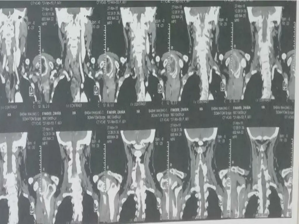 slide42