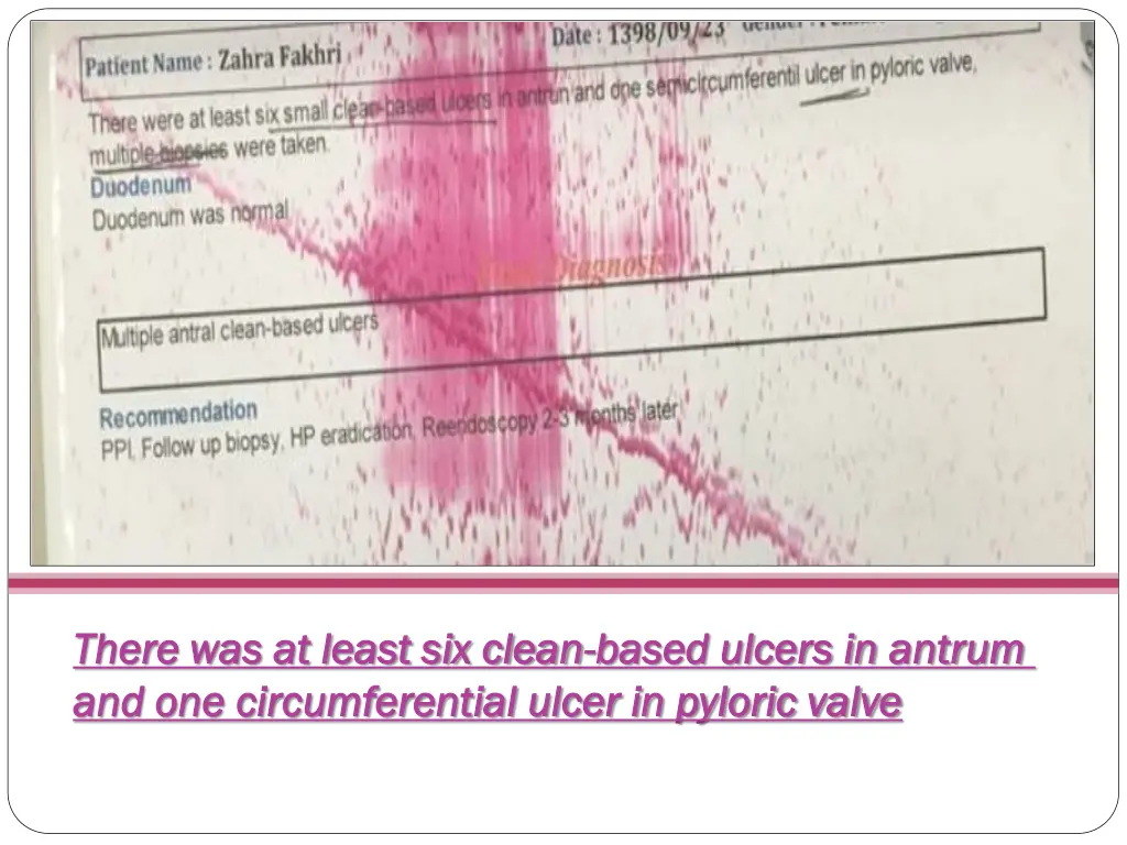 there was at least six clean there was at least