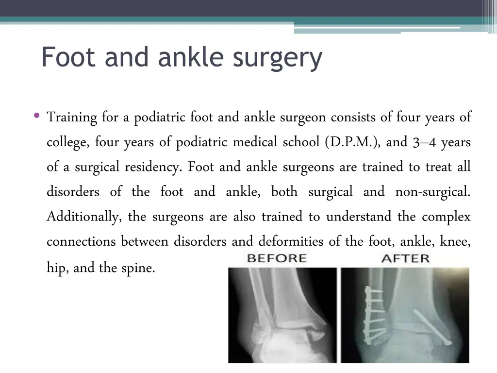foot and ankle surgery 1