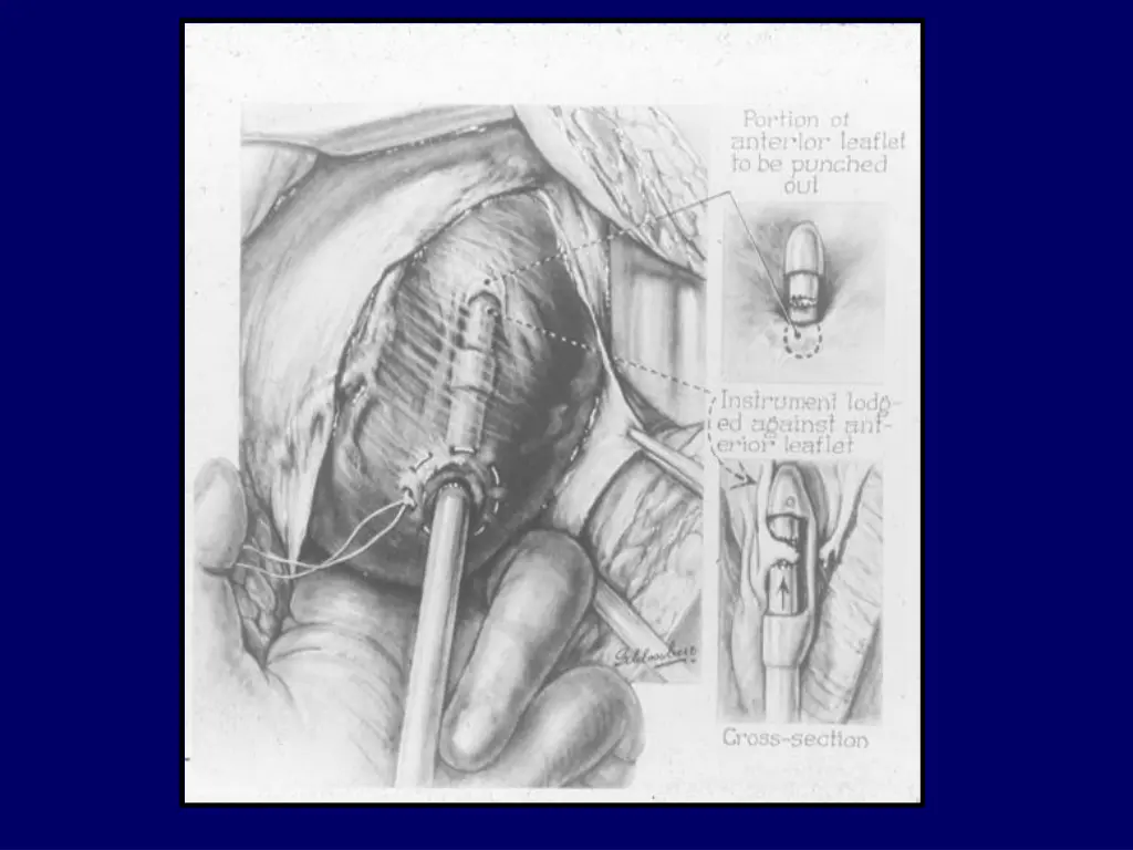 slide19