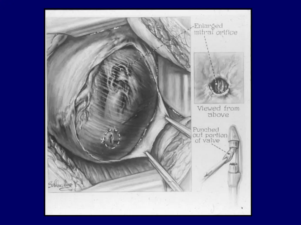 slide20