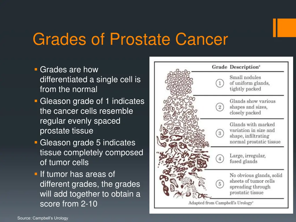 grades of prostate cancer