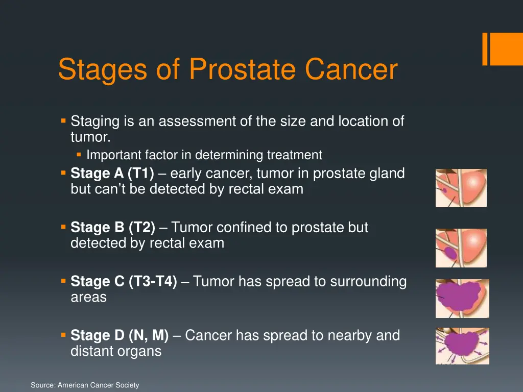 stages of prostate cancer