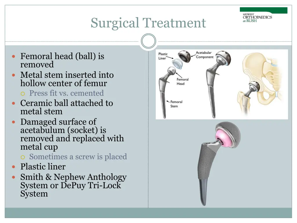 surgical treatment