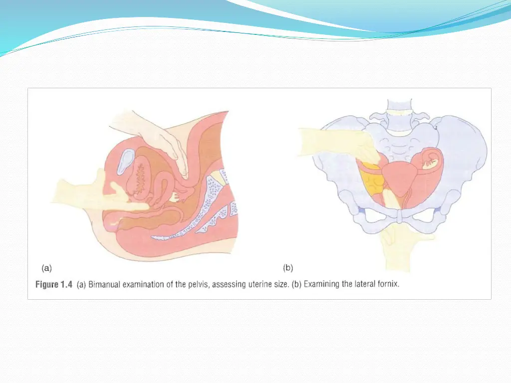 slide8