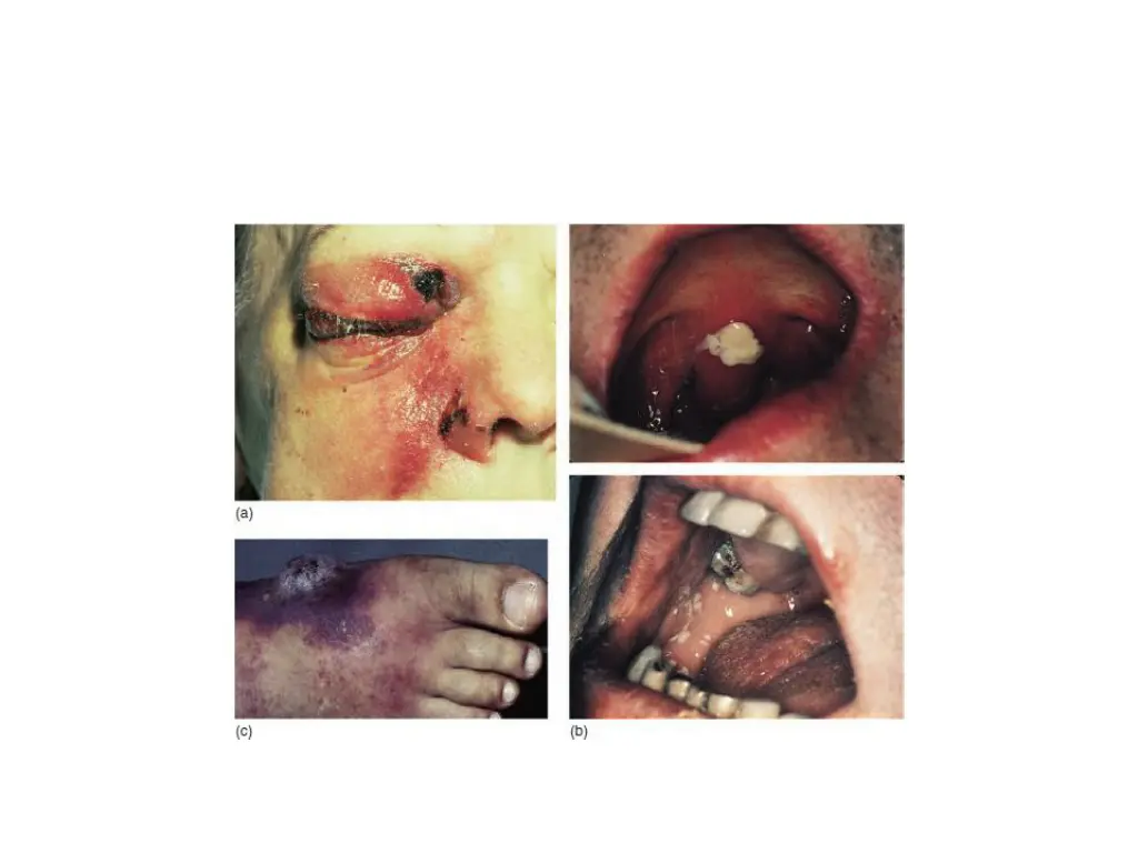 slide18