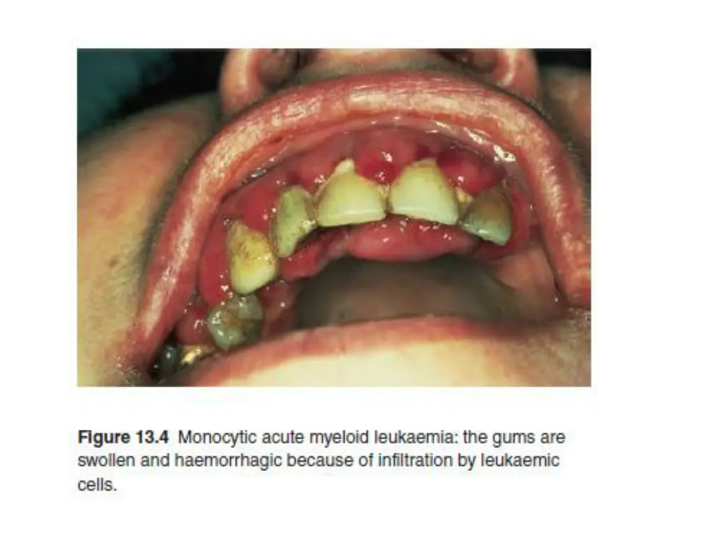 slide19