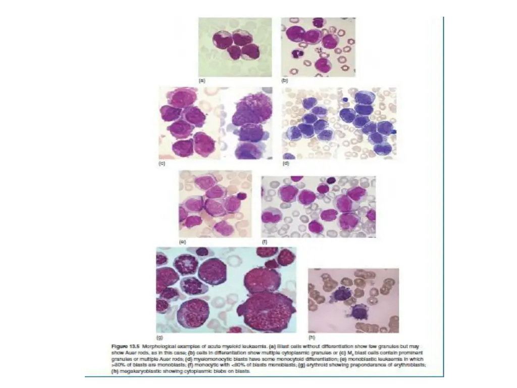 slide21