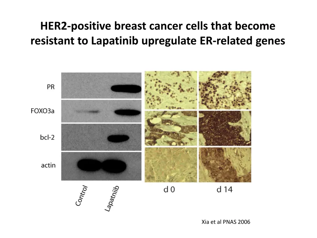 her2 positive breast cancer cells that become