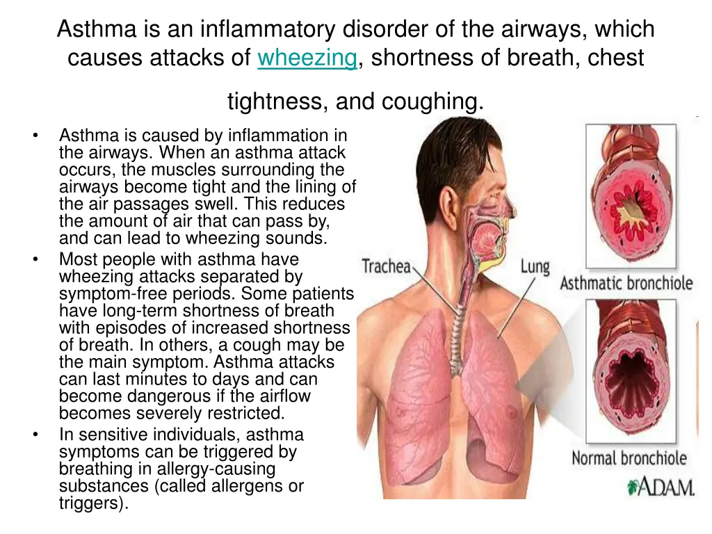 asthma is an inflammatory disorder of the airways