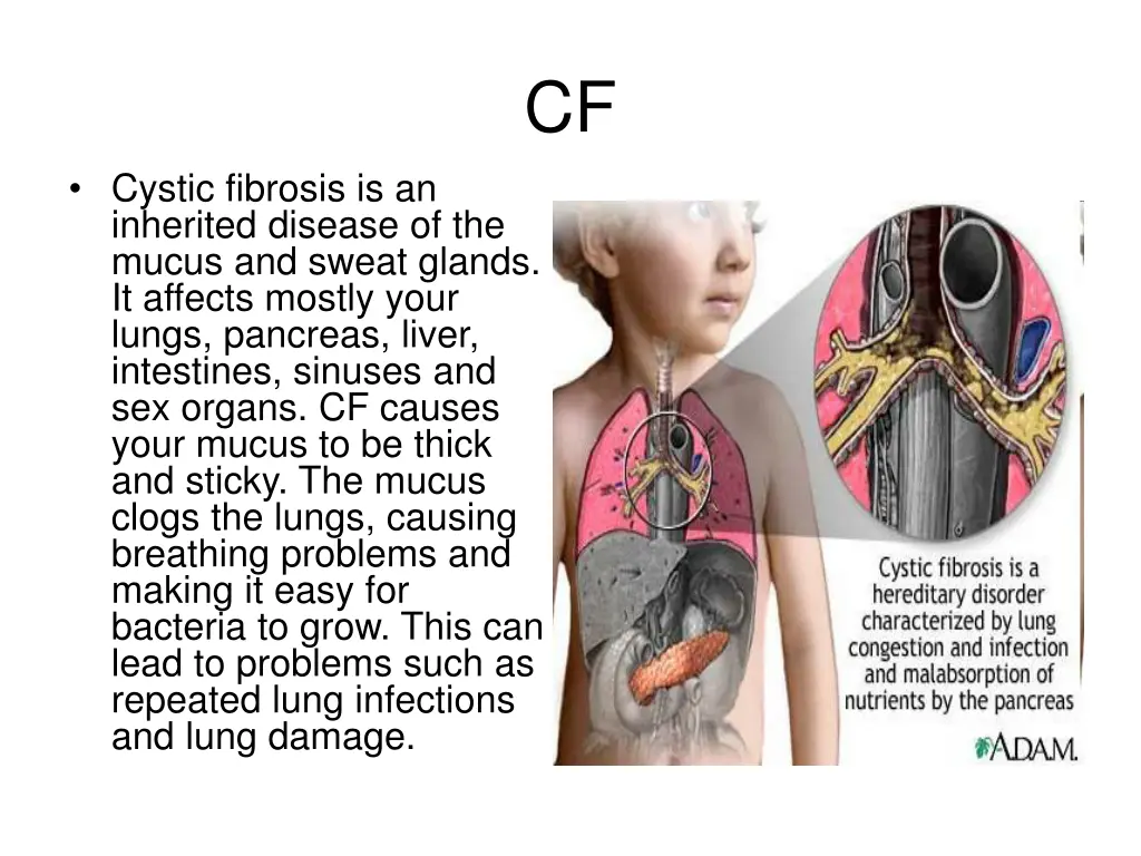slide5