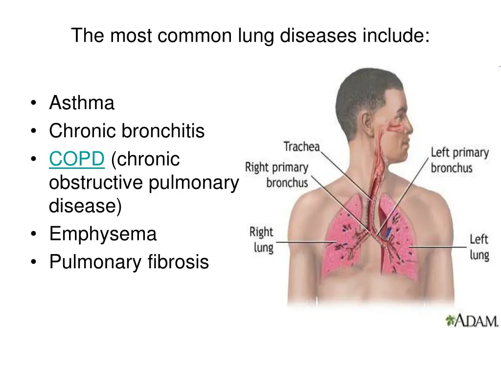 the most common lung diseases include