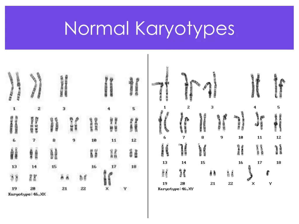 normal karyotypes