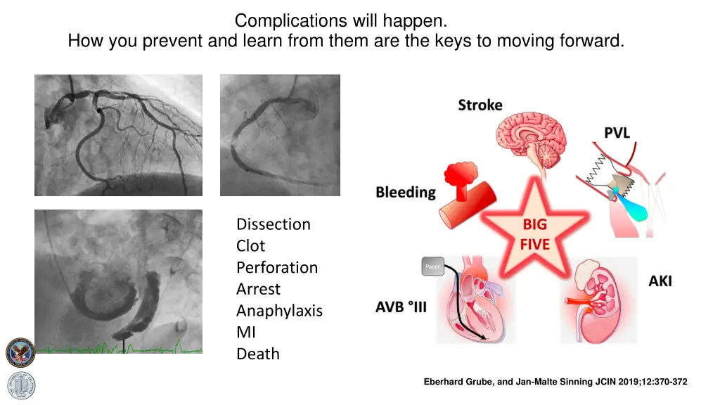 complications will happen