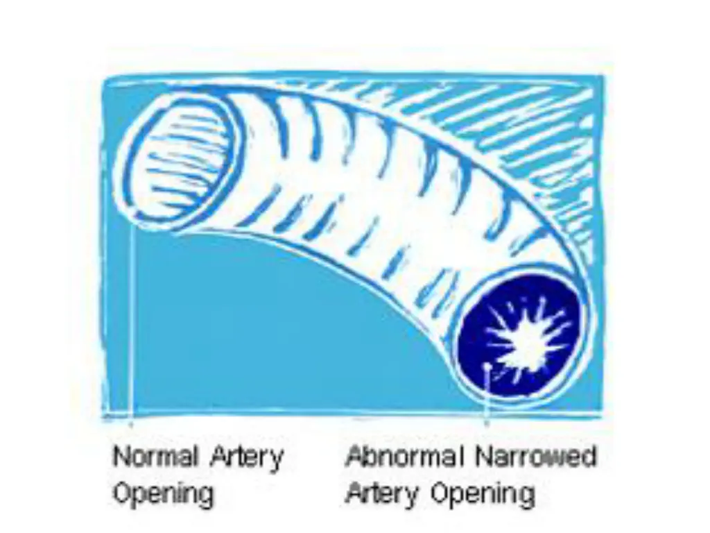 slide5