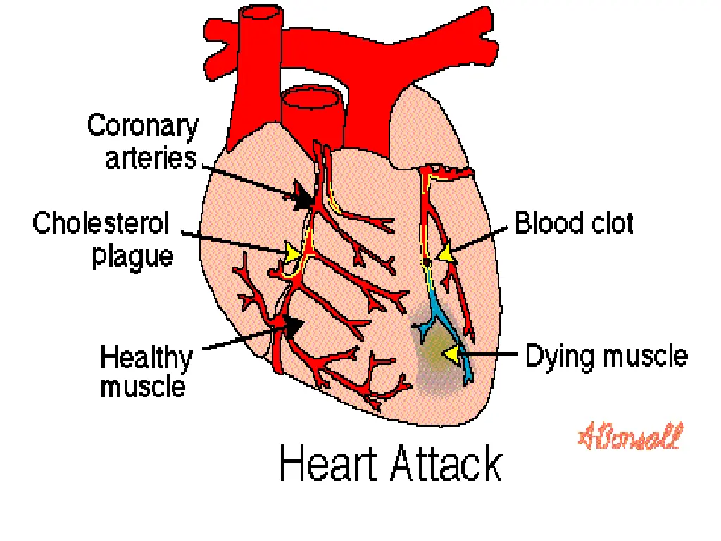 slide9