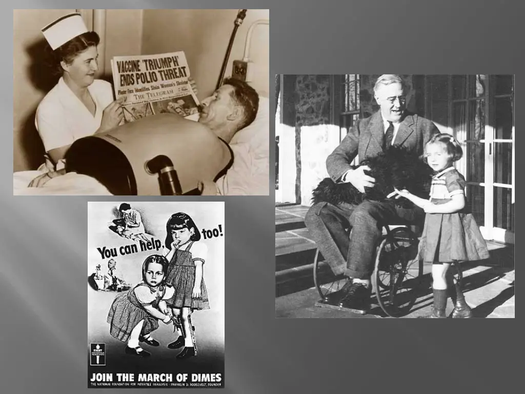 slide33
