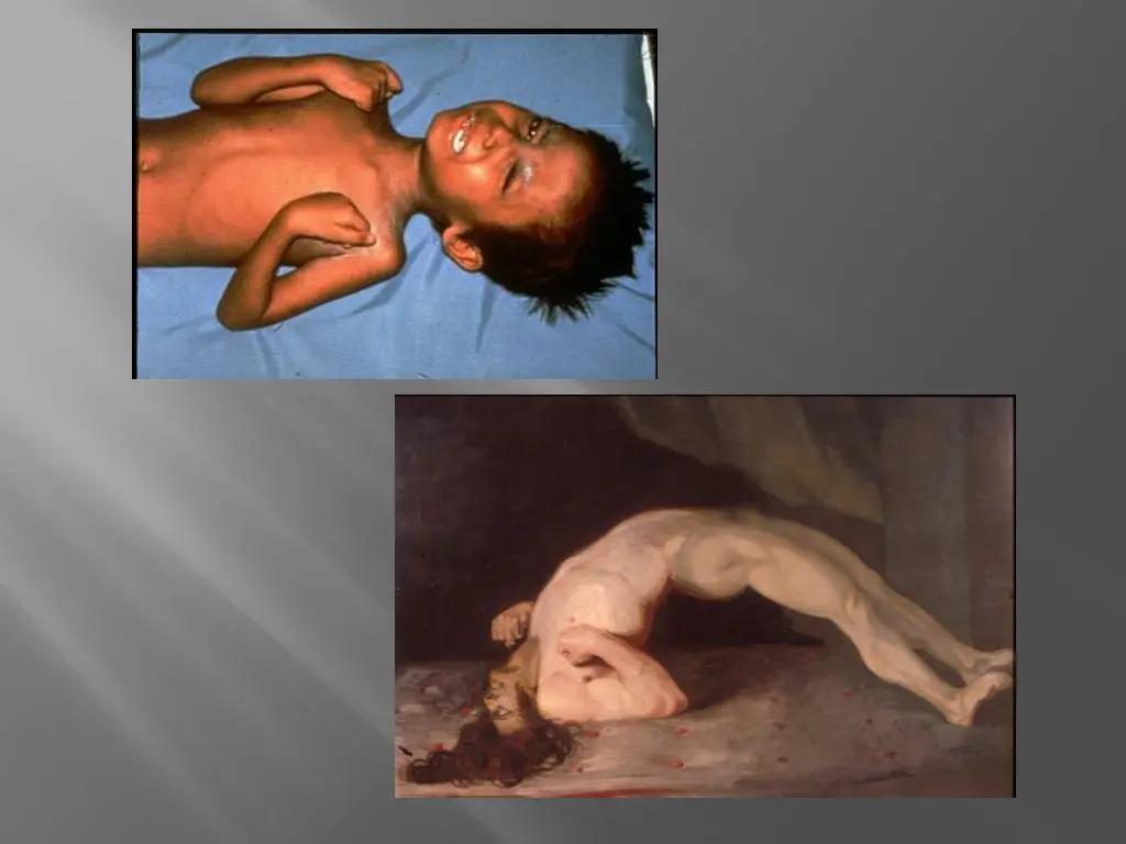 slide38