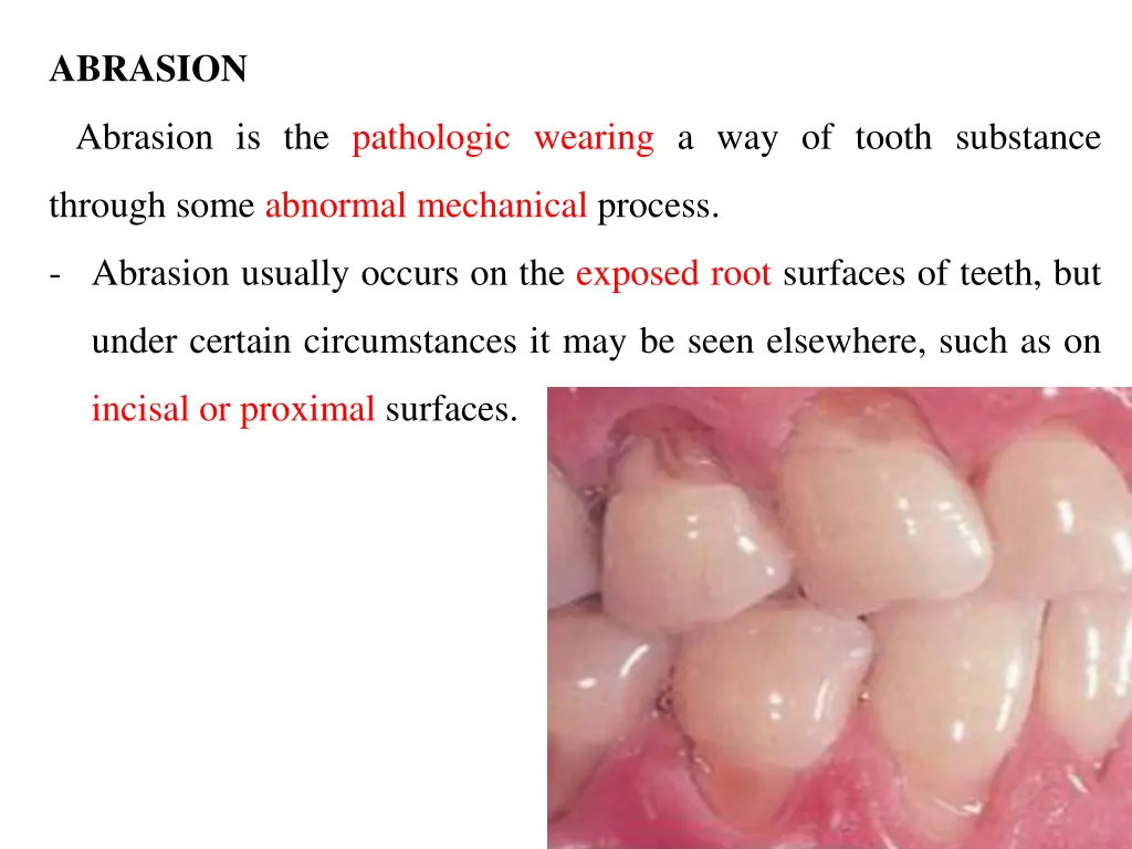 abrasion