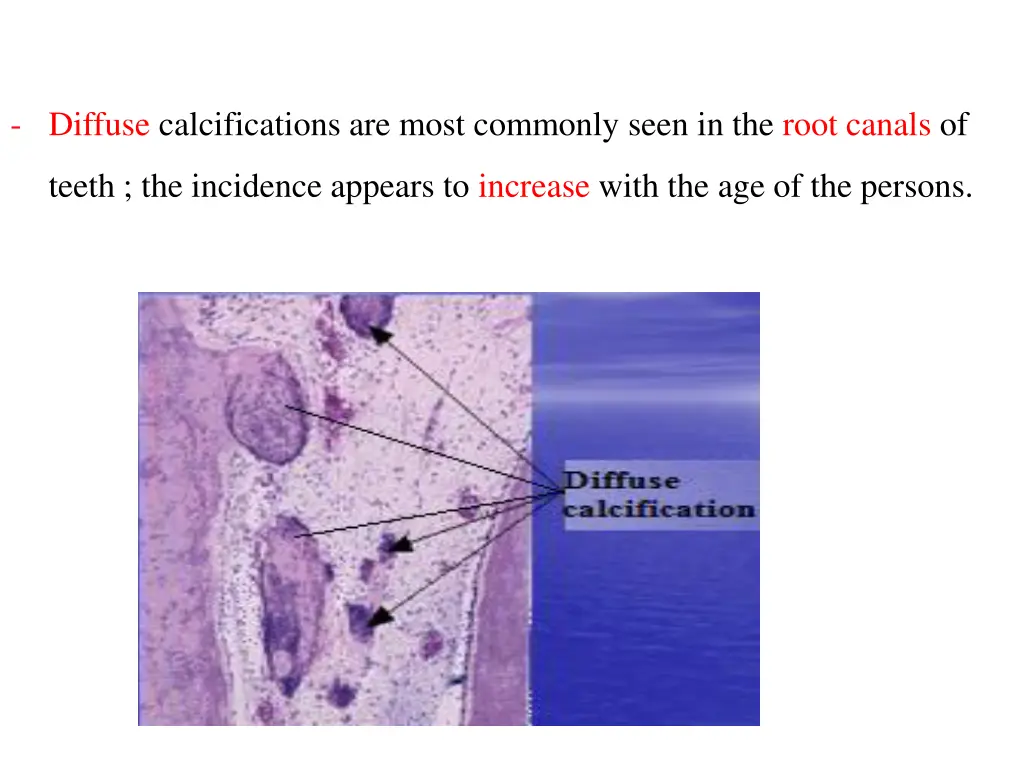 diffuse calcifications are most commonly seen