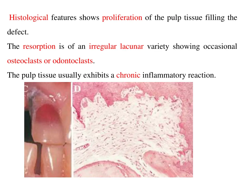 histological features shows proliferation