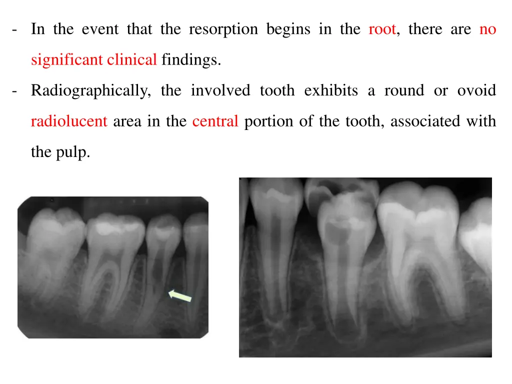 in the event that the resorption begins