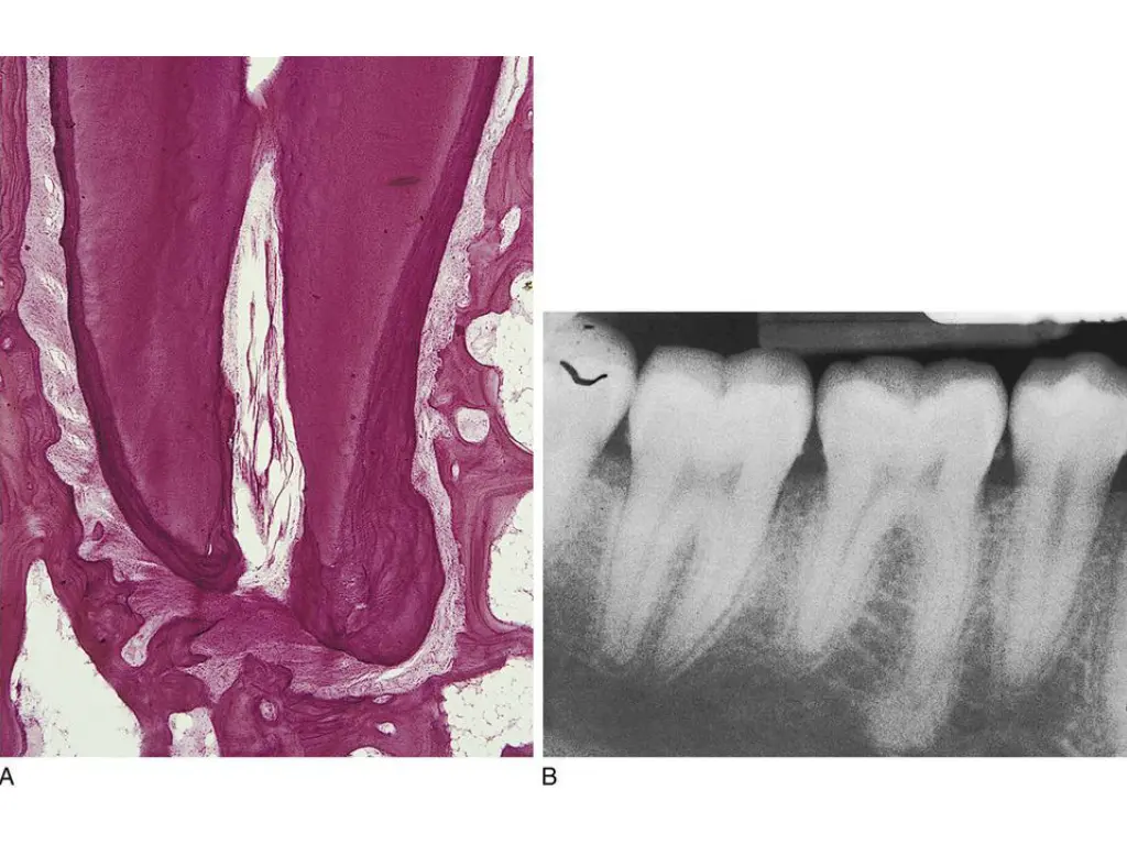 slide34