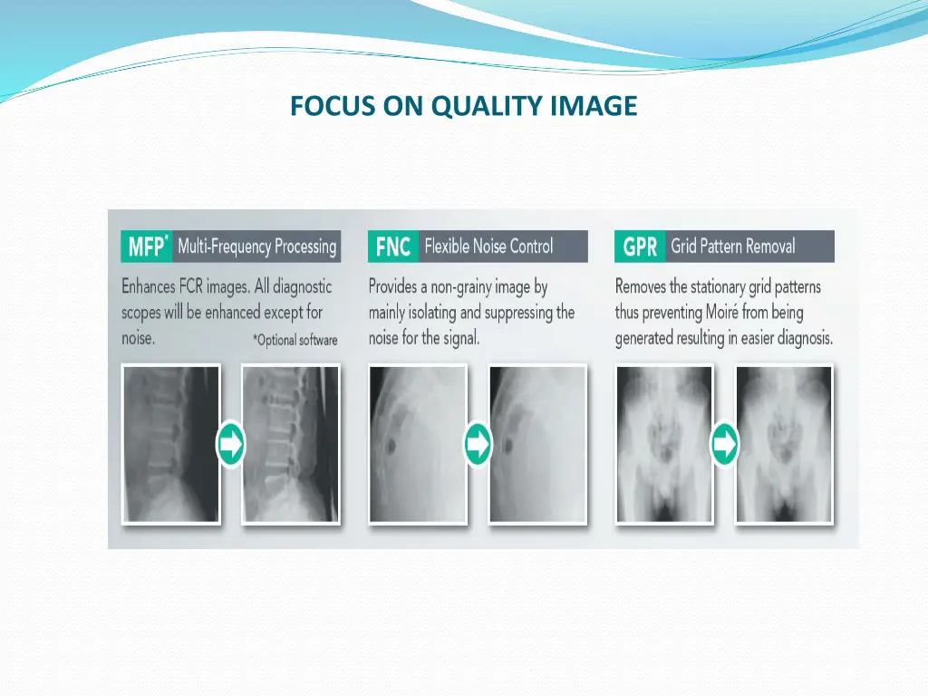 focus on quality image
