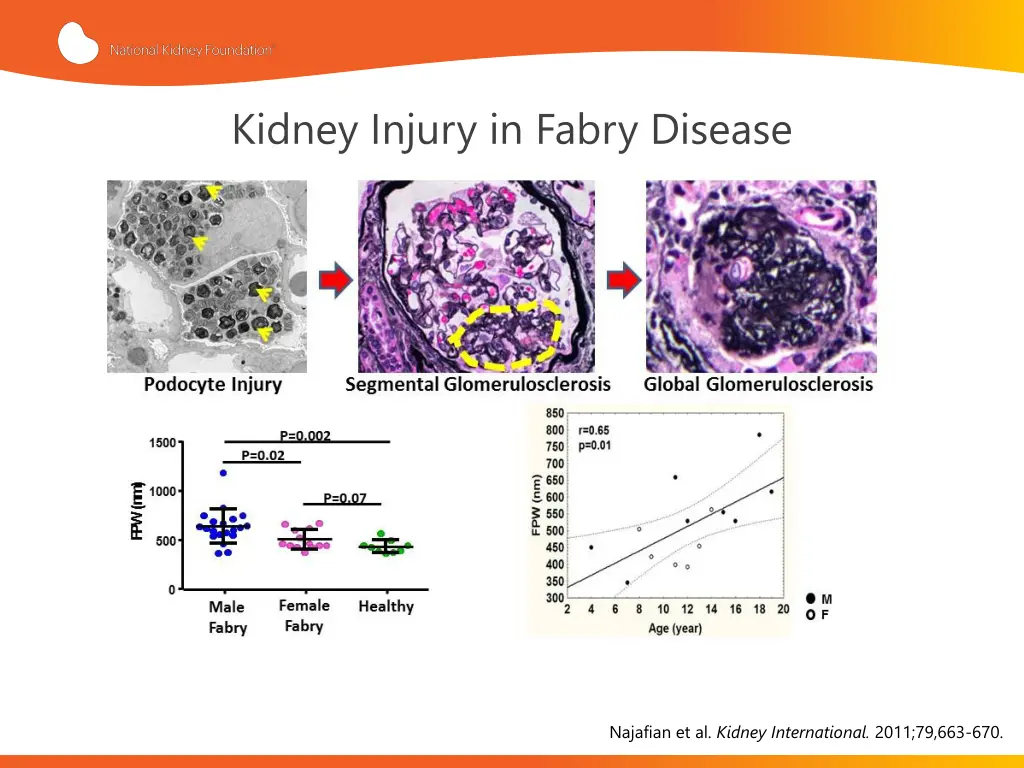 kidney injury in fabry disease