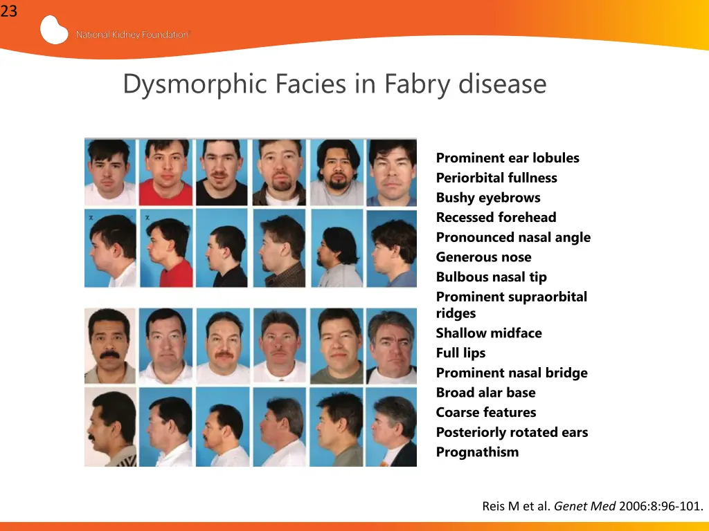 slide23