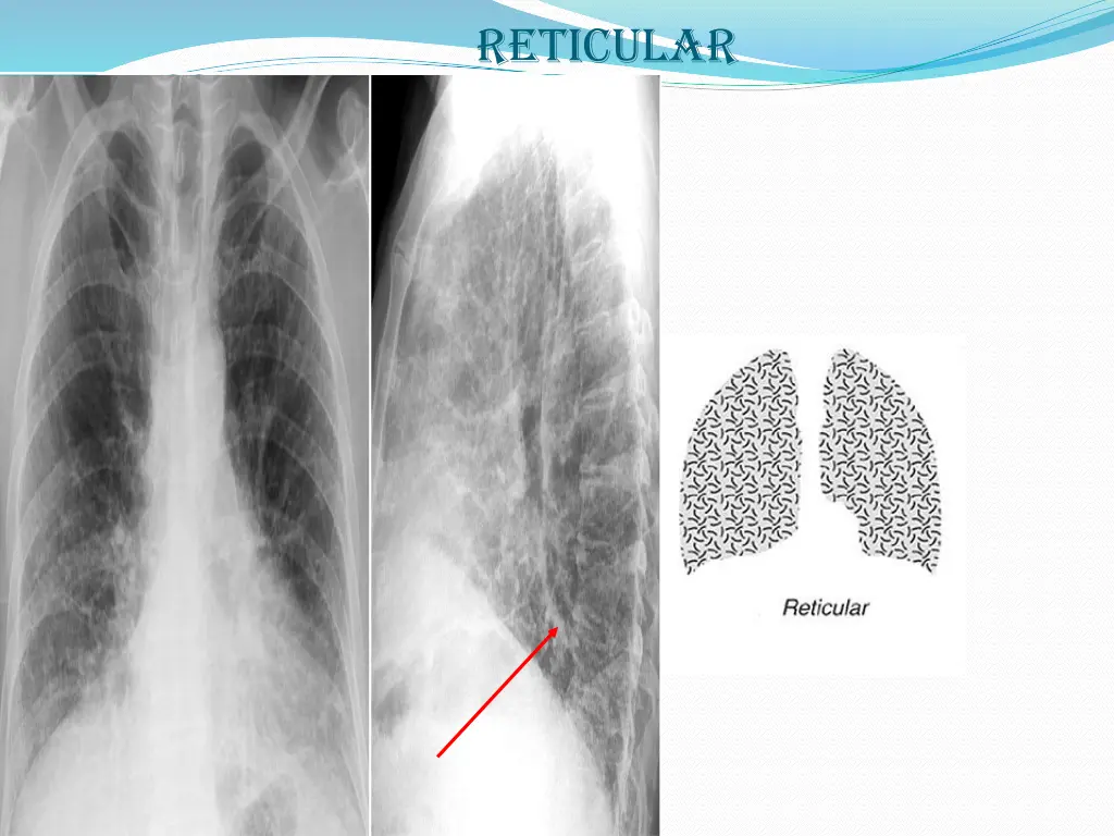 reticular
