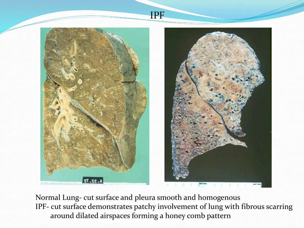 slide25