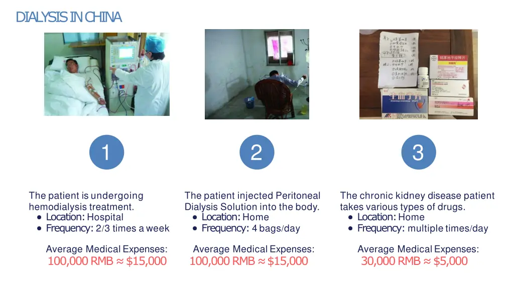dialysis in china