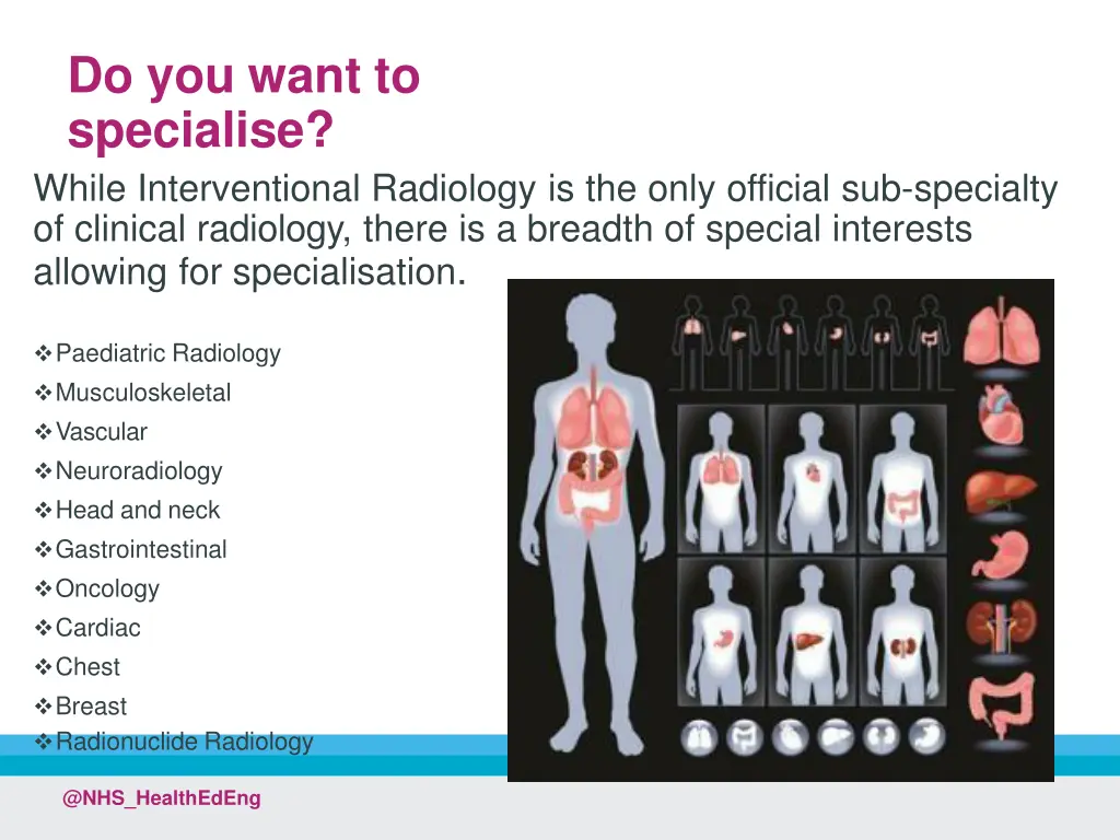 do you want to specialise while interventional