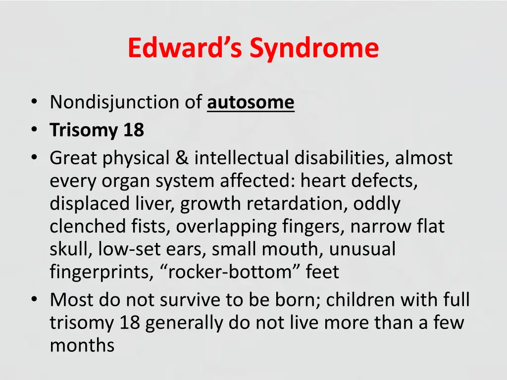 edward s syndrome