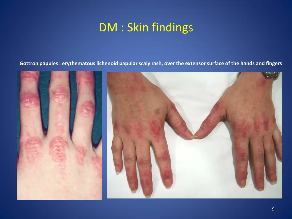 dm skin findings 1