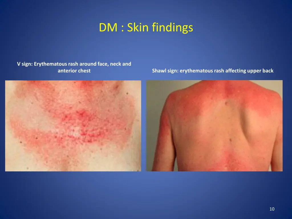 dm skin findings 2