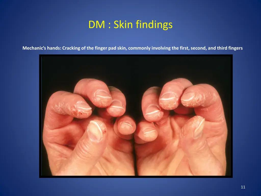 dm skin findings 3
