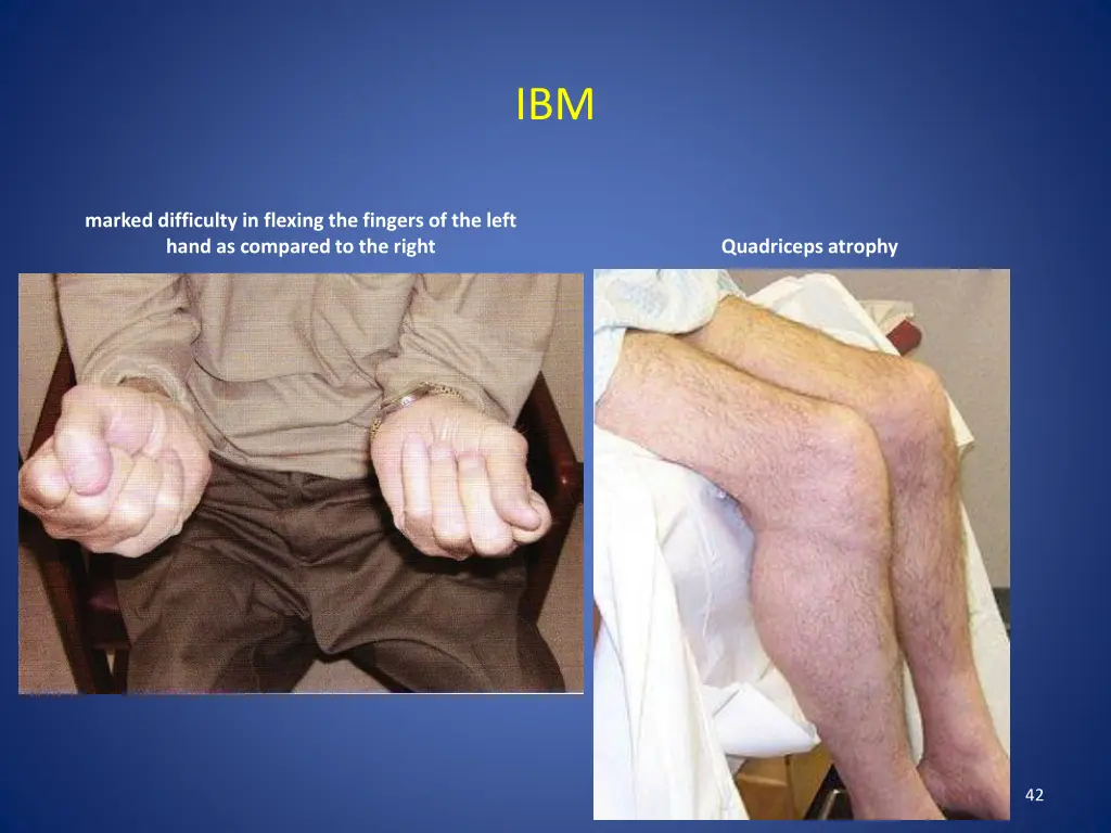 slide42