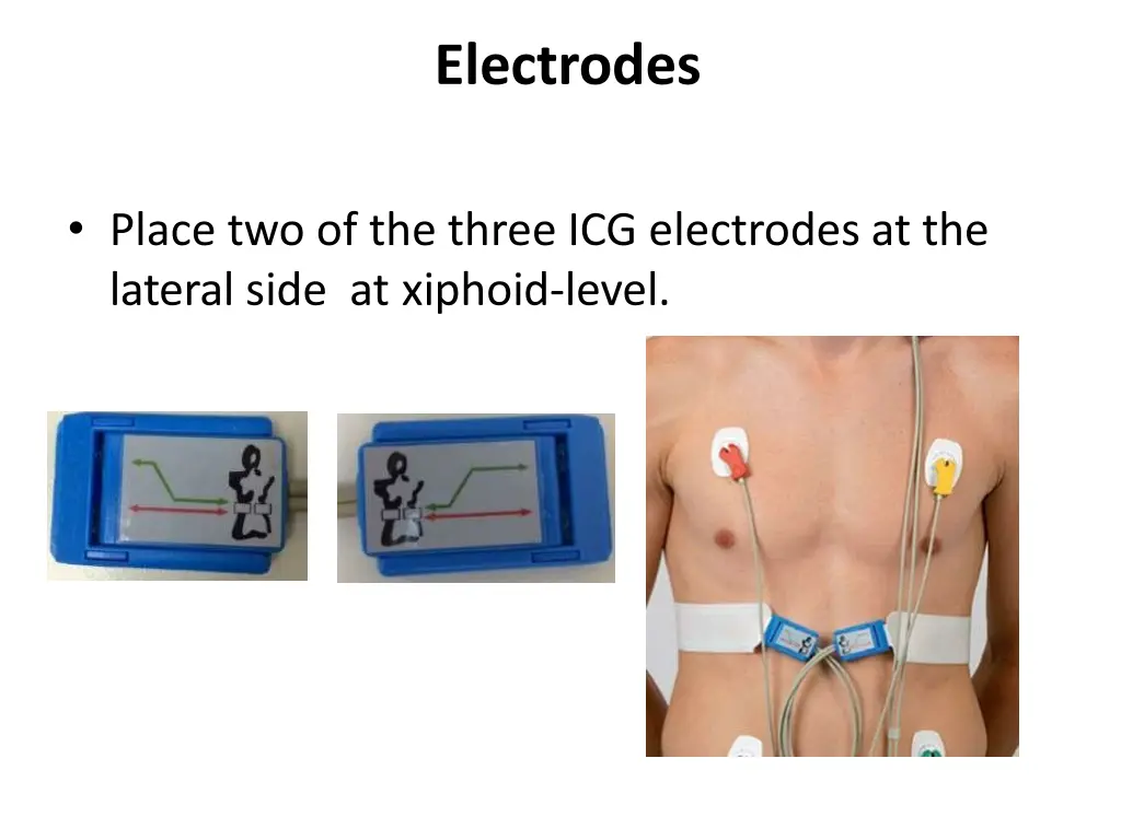 electrodes