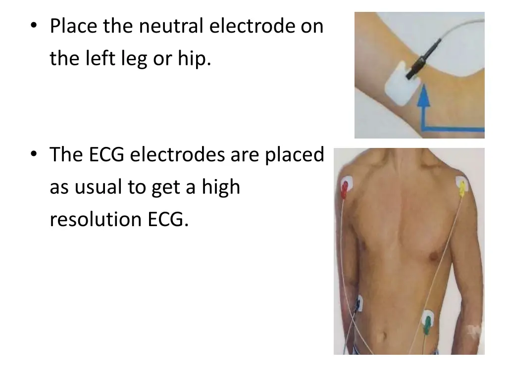 place the neutral electrodeon the left leg or hip