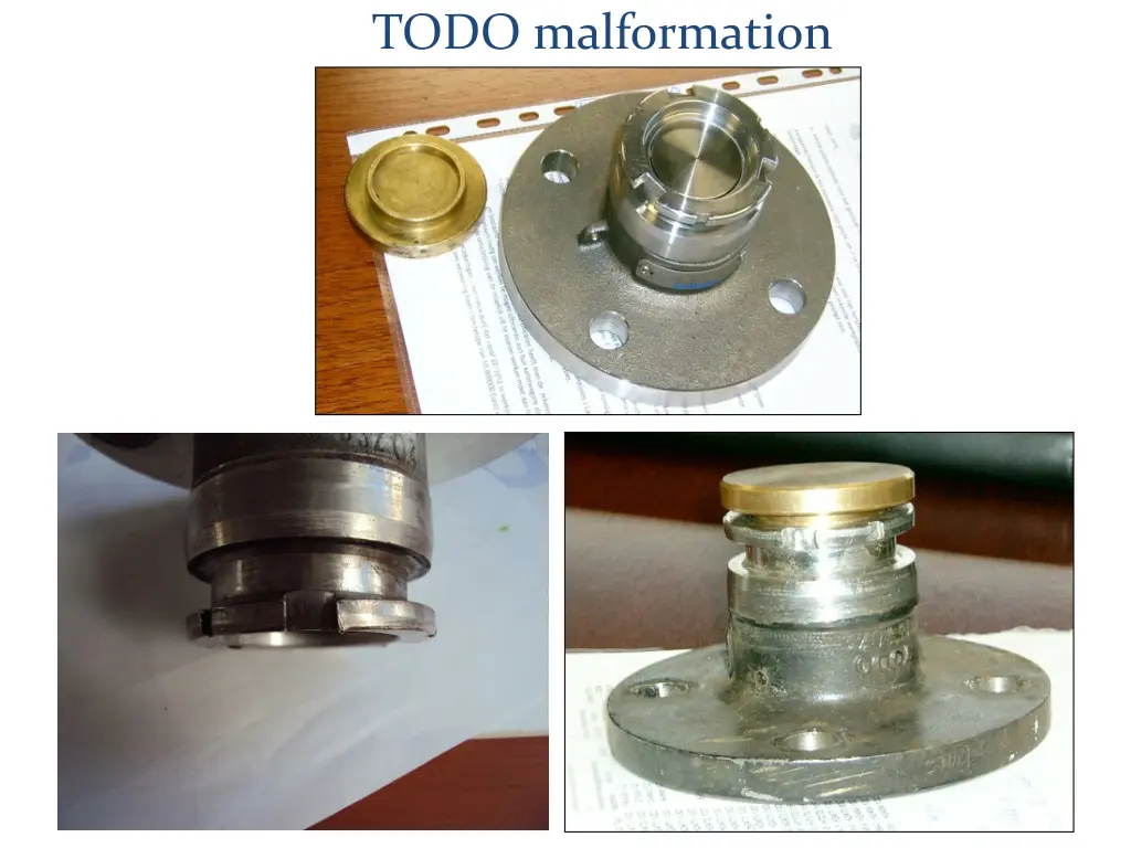 todo malformation