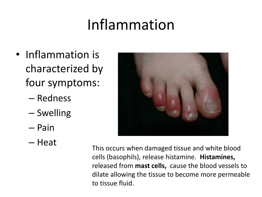 inflammation