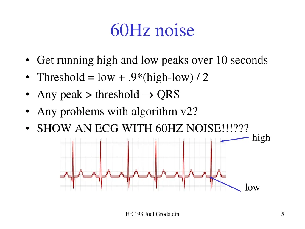 60hz noise