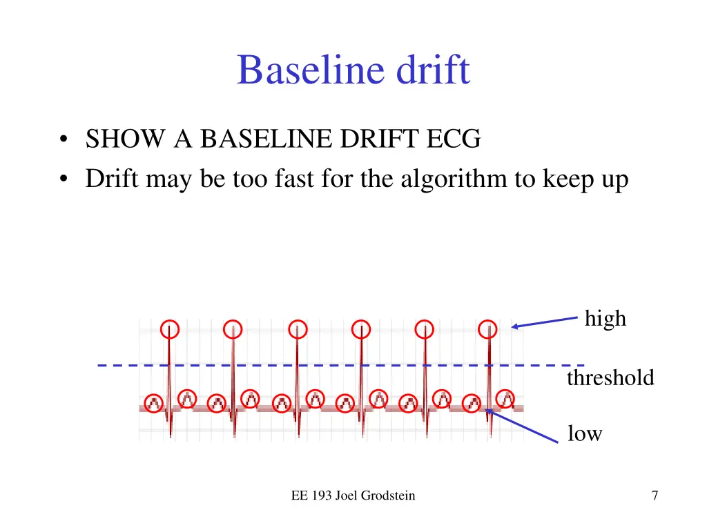 baseline drift